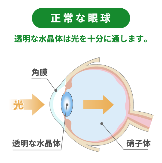 正常な眼球