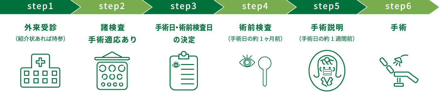 白内障手術までの流れイメージ