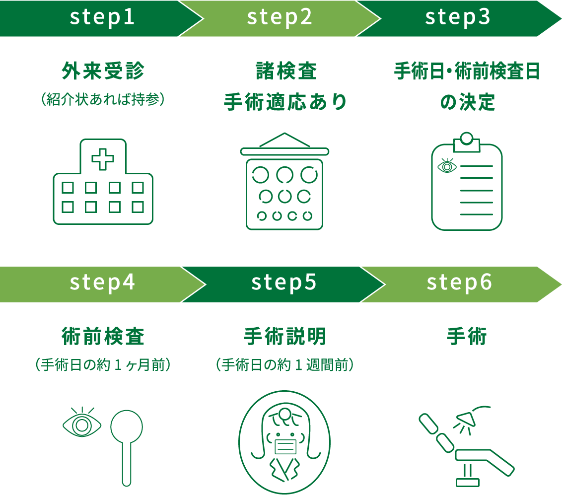 白内障手術までの流れイメージ